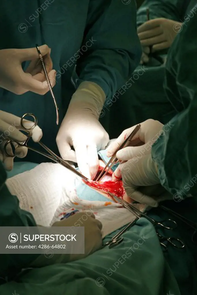 Woman with an exemption by Cesarean section