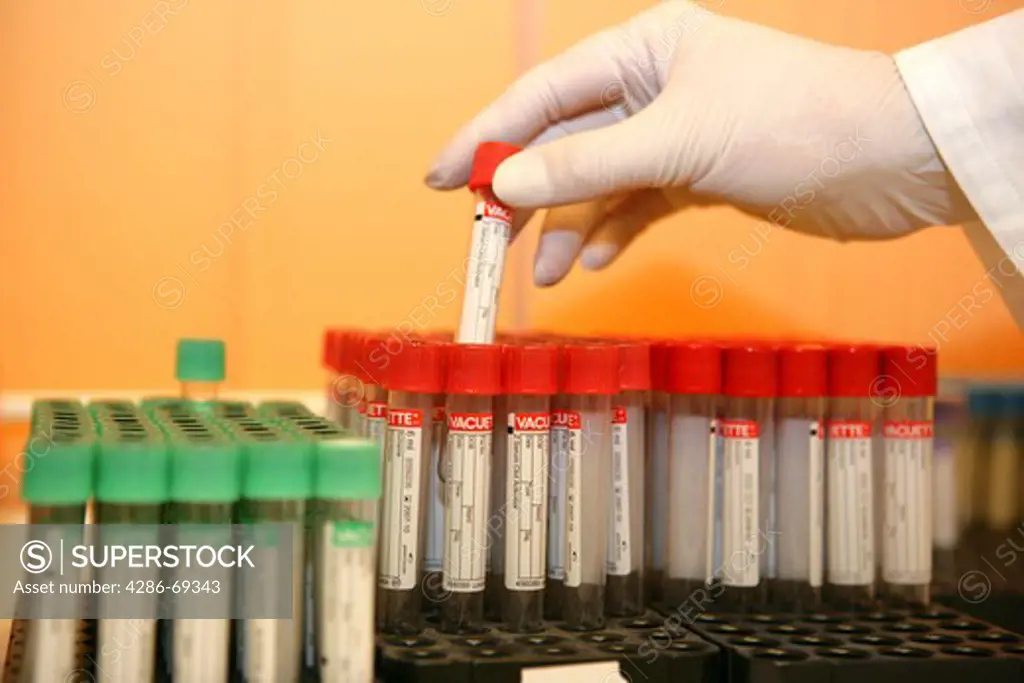 Blood Test Sample Tubes