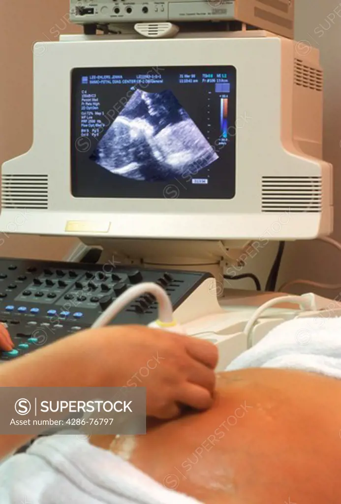 Doctor using probe during ultrasound test with five month old fetus on screen