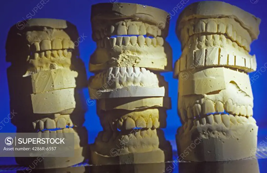 Molds for dentures stacked one on top of another.
