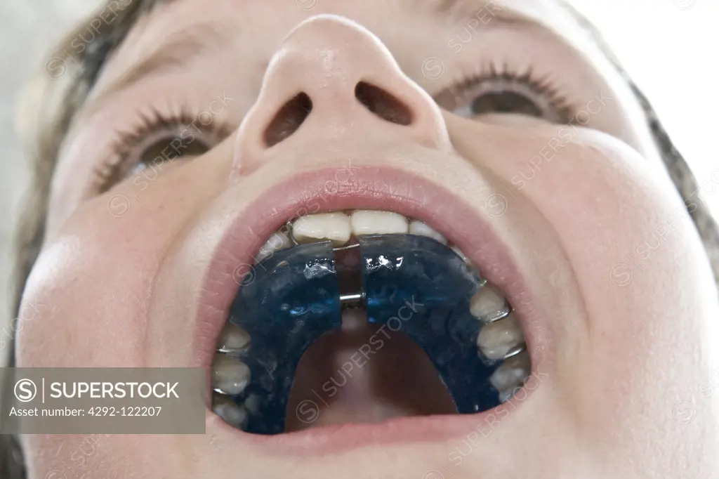 Boy opening braces