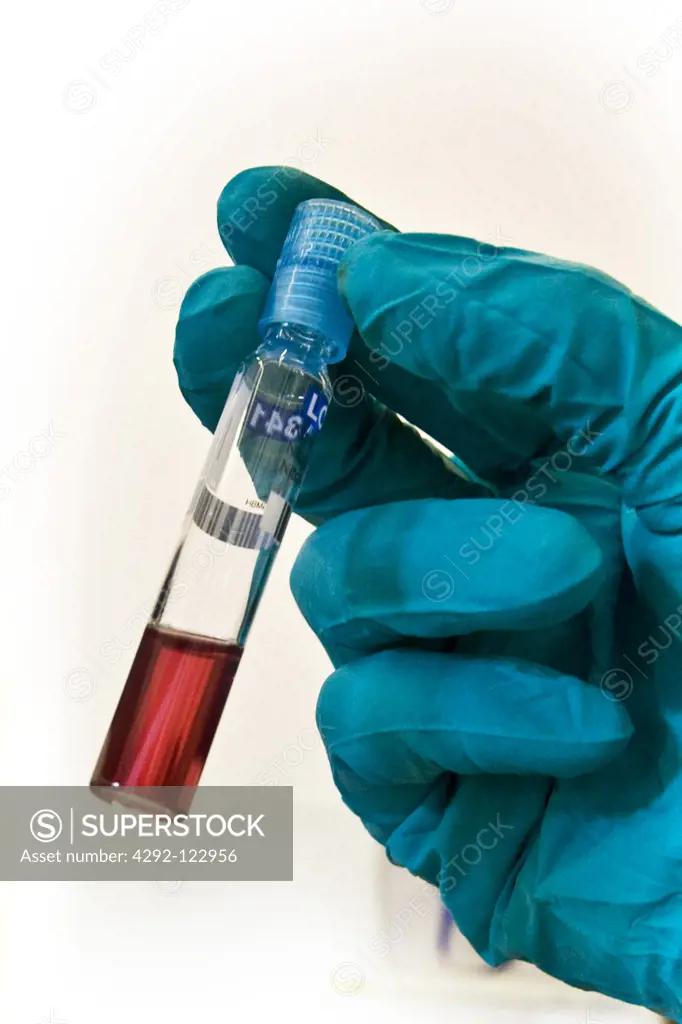 Close up of hand of scientist with test tube