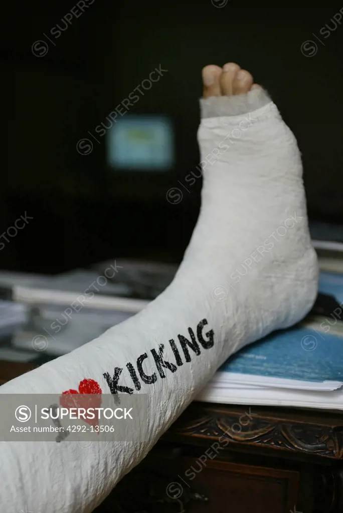 Broken foot with plaster