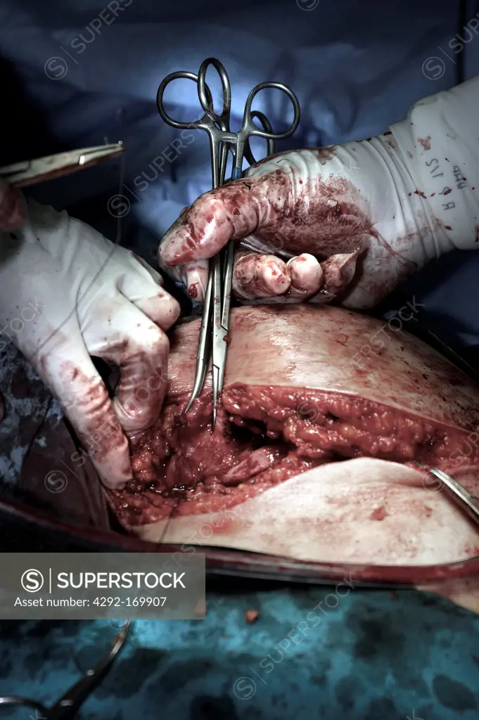 Surgeon at work