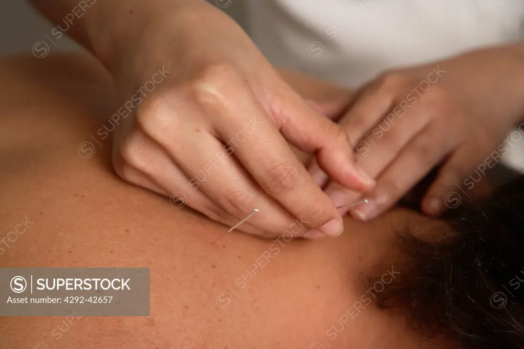 Acupunture