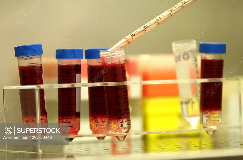 Blood test in cell factory