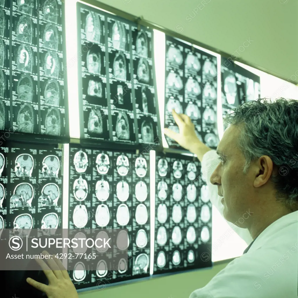 Doctor checking brain scans