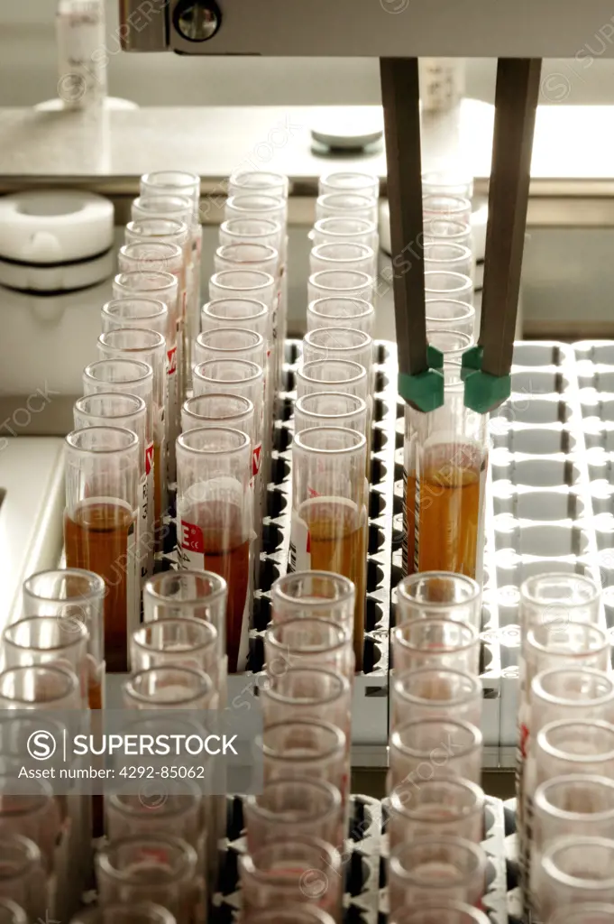 Urine samples in laboratory