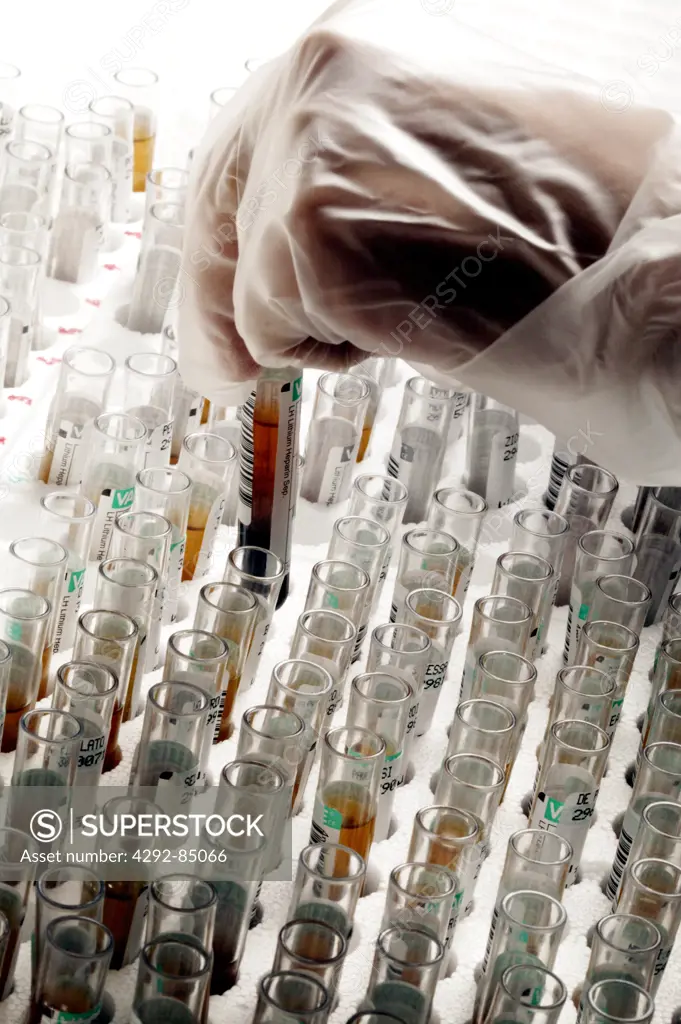 Laboratory technician holding test tubes samples of blood
