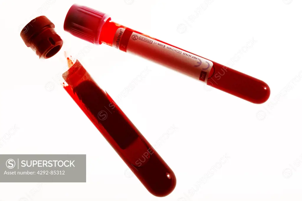 Blood Samples - Human blood for testing