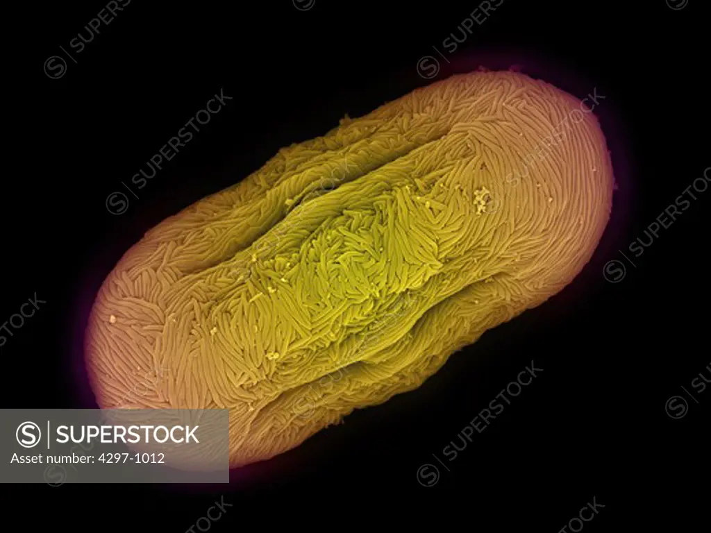Colorized scanning electron microscope image of dill pollen. The pollen has been acetolyzed to remove cytoplasm and pollenkit in order to reveal the intricate wall structure. This image shows a single grain of dill pollen. Family: Apiaceae, Anethum graveolens