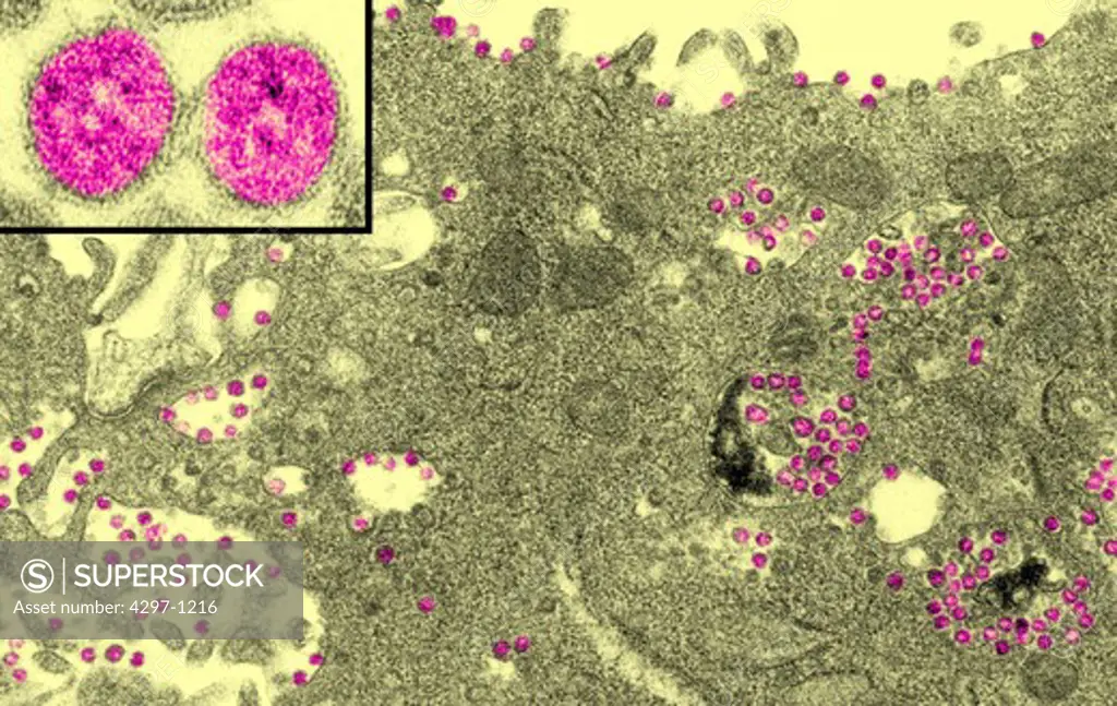 Scanning Electron micrograph of infected Vero E6 cell showing coronavirus particles within cytoplasmic membrane-bound vacuoles and the cisternae of the rough endoplasmic reticulum