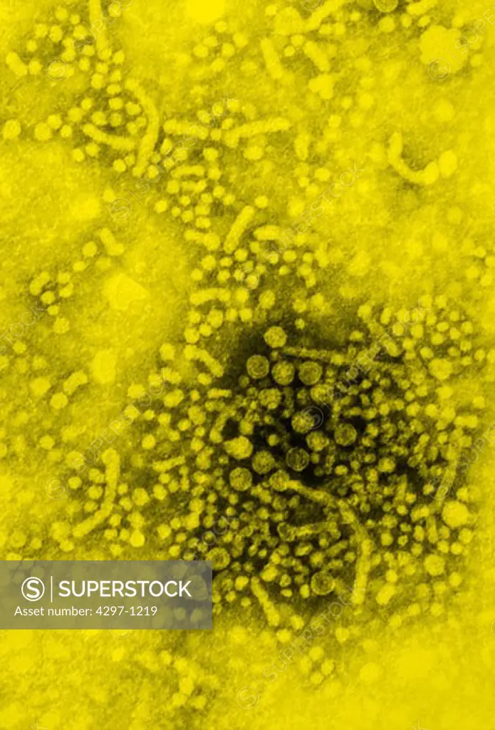 Negatively-stained transmission electron micrograph showing hepatitis B virus (HBV) virions
