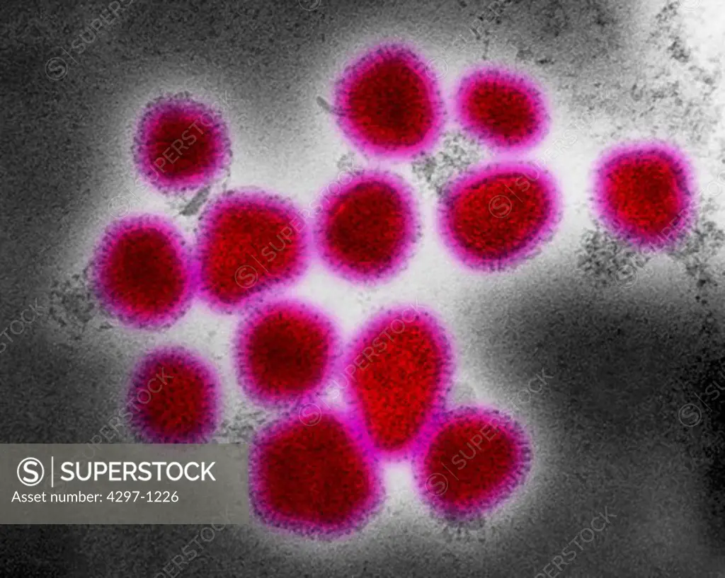 Negatively-stained transmission electron micrograph of Hong Kong flu virus virions
