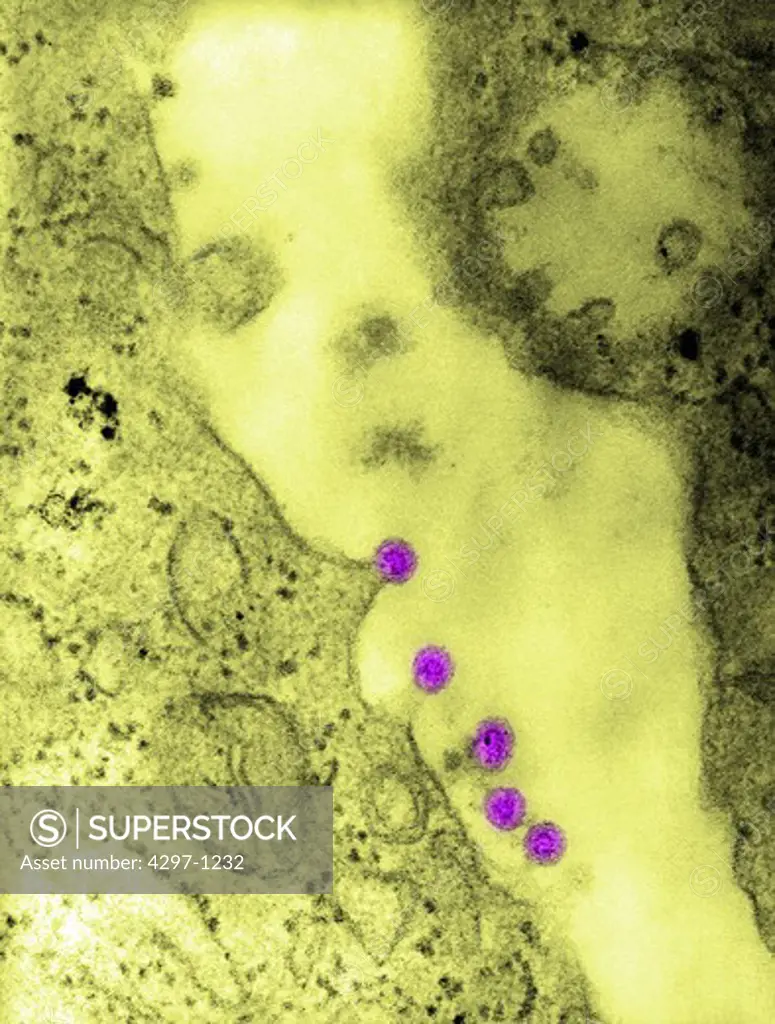 Negatively-stained TEM image of Rubella virus virions