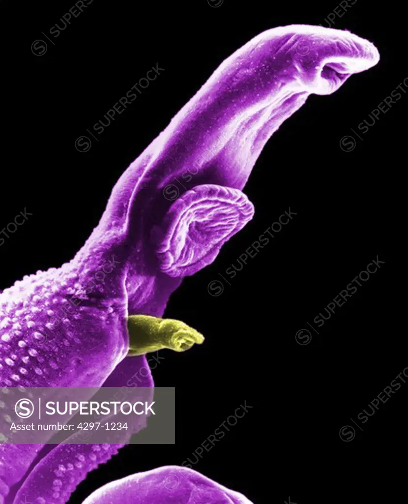 SEM image of the front end of an adult male schistosoma worm parasite