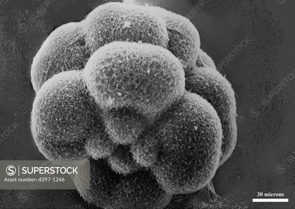 Scanning electron microscopic image of Lytechinus pictus (sea urchin) embryo at the 16-cell stage