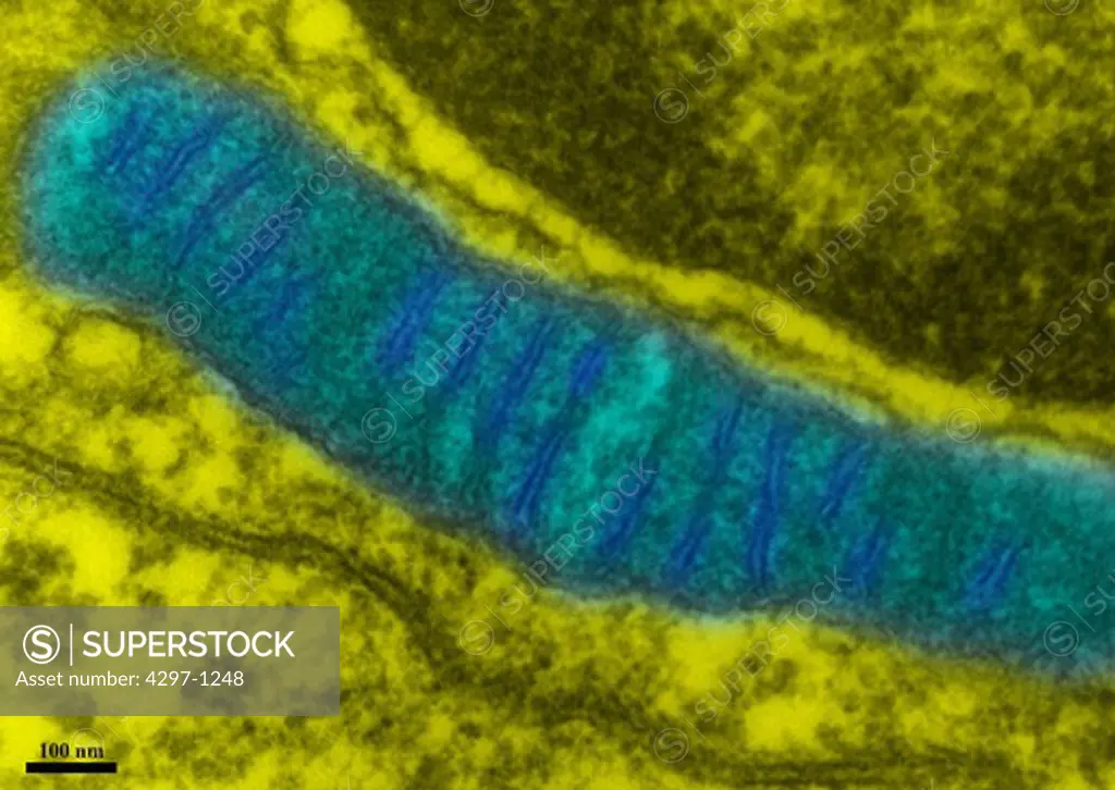 Transmission electron microscopic image of a mitochondrion