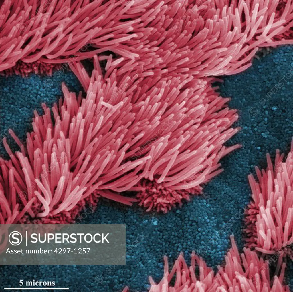 Scanning electron microscopic image of lung trachea epithelium