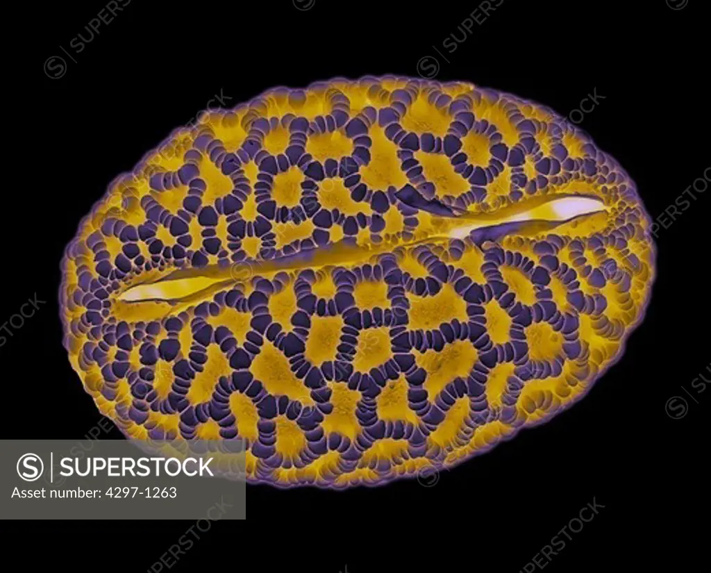 Scanning electron microscopic image of a pollen grain of a Lily