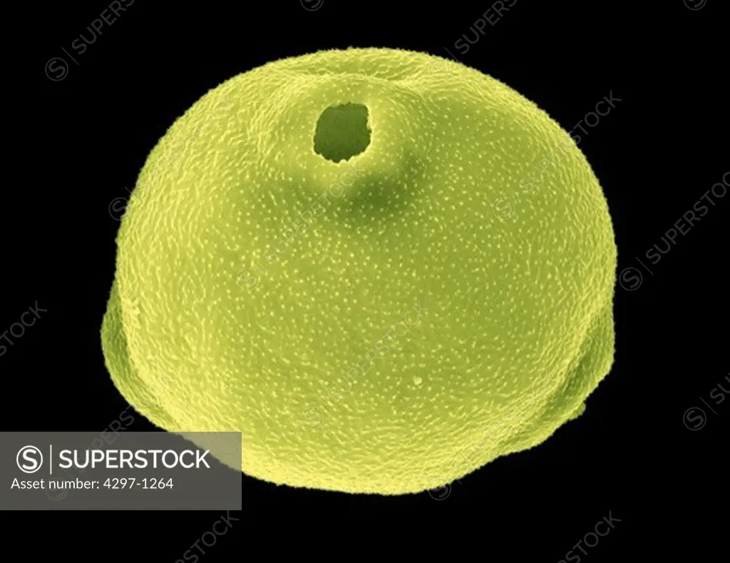 Scanning electron microscopic image of a pollen grain of Birch