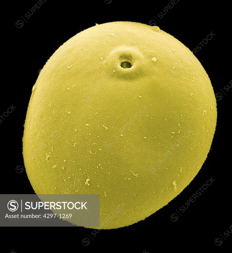 Scanning electron microscopic image of a pollen grain of corn