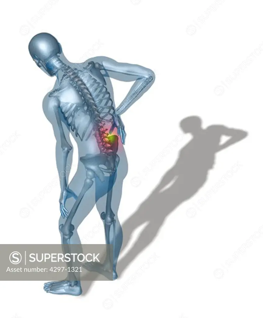A man hunched over holding his back, in pain