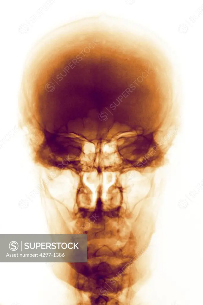 Normal skull x-ray