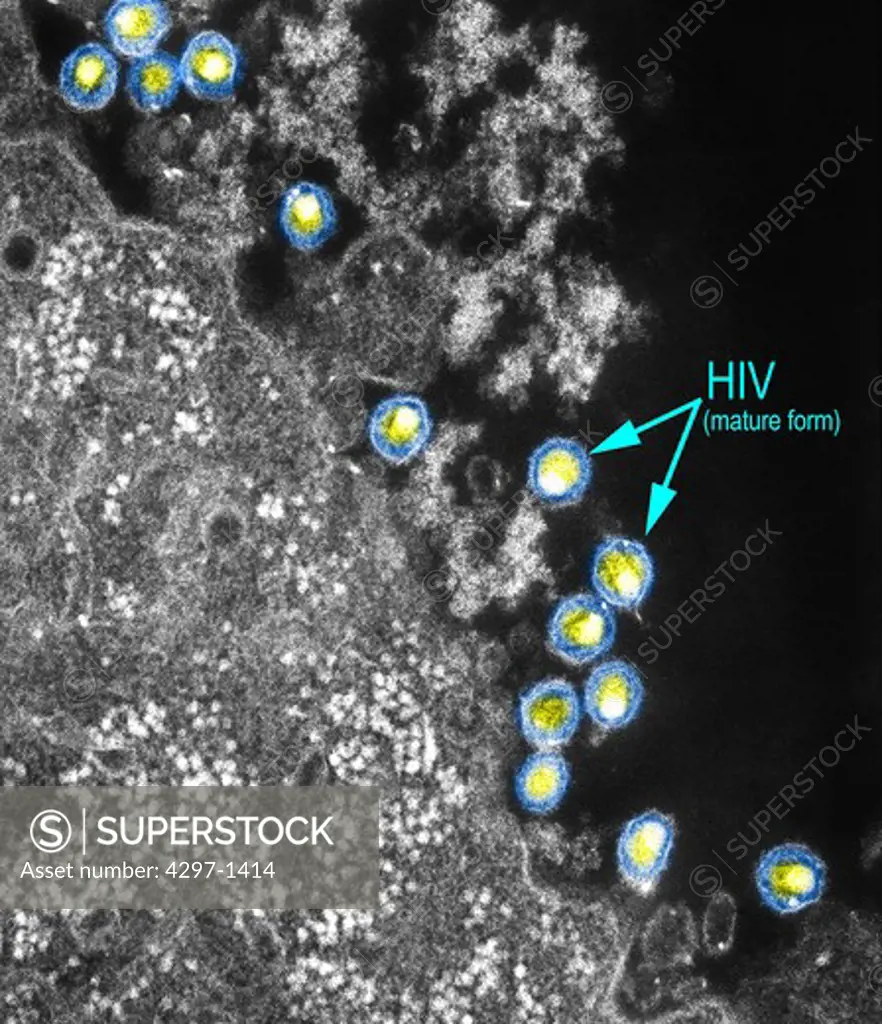 Mature forms of the human immunodeficiency virus (HIV). The Human Immunodeficiency Virus (HIV) is a retrovirus, was identified in 1983 as the etiologic agent for the Acquired Immunodeficiency Syndrome (AIDS)