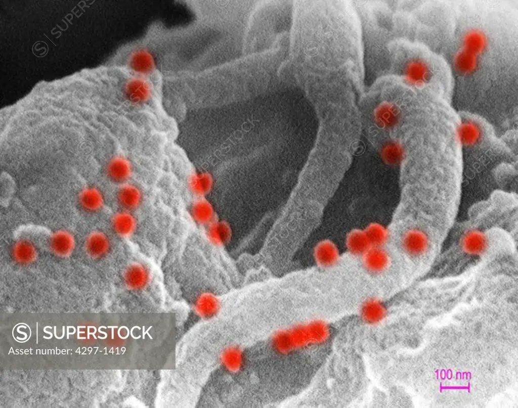 This scanning electron micrograph shows human immunodeficiency virus (HIV-1), (spherical in appearance) co-cultivated with human lymphocytes.