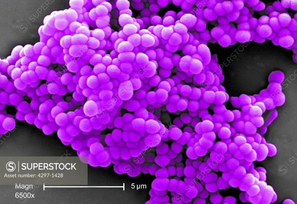 Beta strep Group C, scanning electron micrograph (SEM) at a magnification of 6,500X, showing a cluster of Gram-positive, beta-hemolytic Group C Streptococcus sp