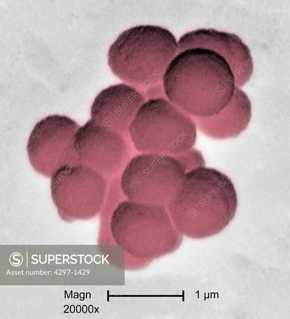 Scanning electron micrograph revealed a small clustered group of Gram-positive beta-hemolytic Group C Streptococcus spp. bacteria