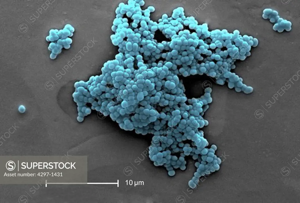 Scanning electron micrograph revealed a number of clusters of Gram-positive beta-hemolytic Group C Streptococcus spp. bacteria