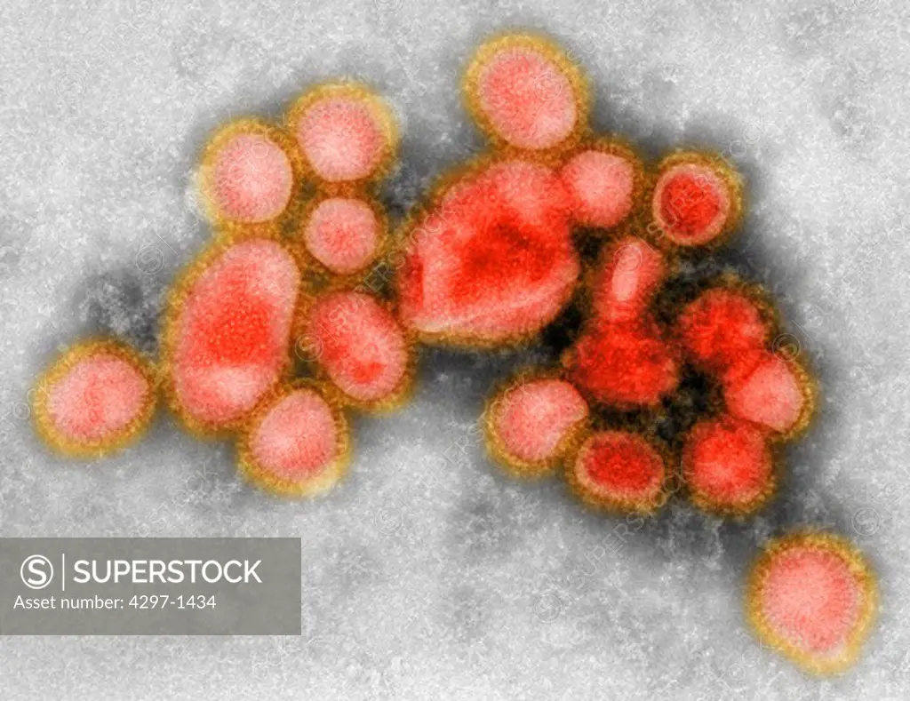 Images of the newly identified H1N1 influenza virus taken in the CDC Influenza Laboratory. This preliminary negative stained transmission electron micrograph shows some of the ultrastructural morphology of the A/CA/4/09 swine flu virus
