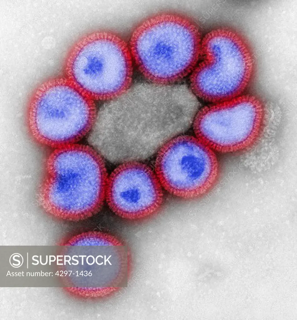 Negative-stained transmission electron micrograph depicts the ultrastructural details of a number of influenza virus particles
