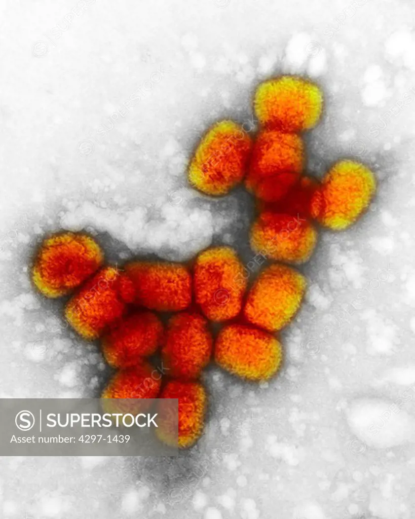 A transmission electron micrograph of smallpox viruses using a negative stain technique. Smallpox is a serious, highly contagious, and sometimes fatal infectious disease. There is no specific treatment for smallpox disease