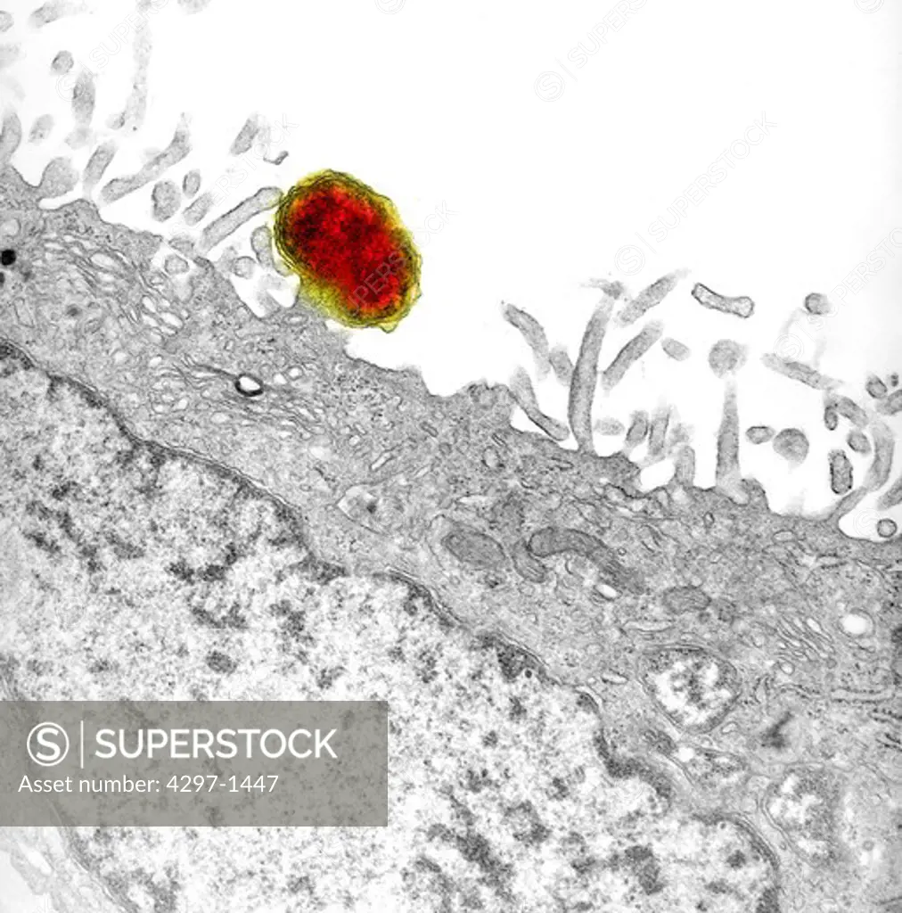 Transmission electron micrograph of a murine peritoneal mesothelial cell that was infected with multiple free cytoplasmic Gram-negative Orientia tsutsugamushi rickettsial microorganisms
