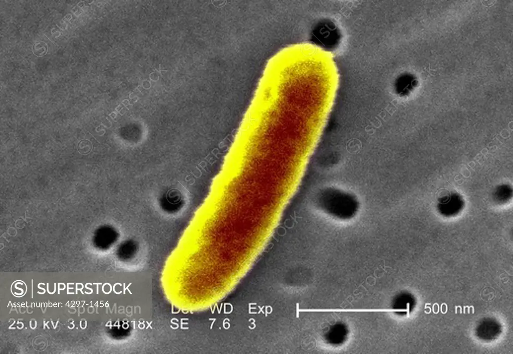Scanning electron micrograph revealed some of the morphologic details displayed by a single Gram-negative Escherichia coli bacterium