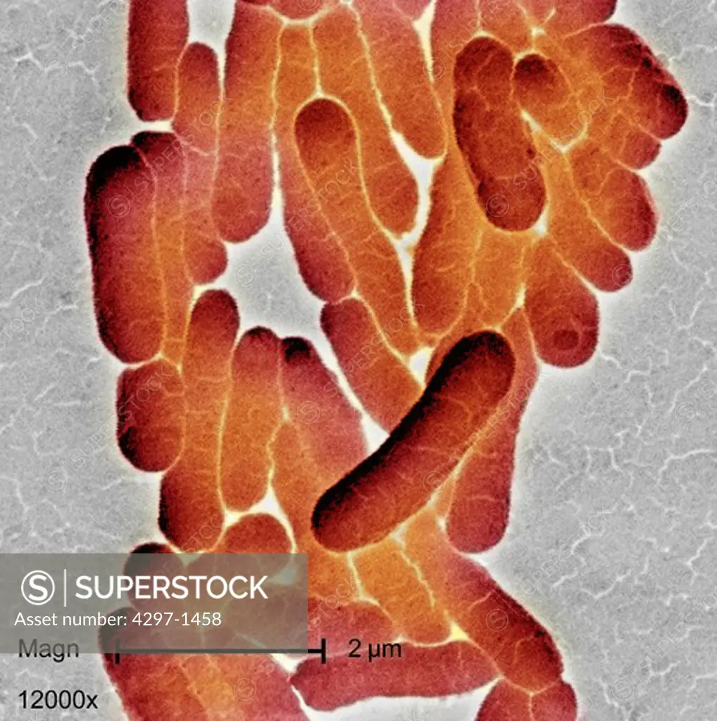 Scanning photomicrograph of clustered Gram-negative Salmonella typhimurium bacteria at a high magnification of 12000X