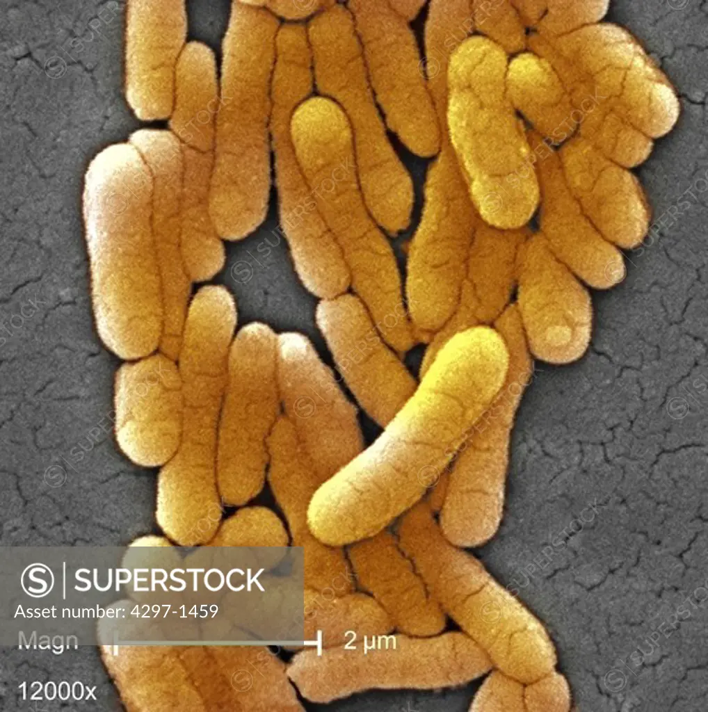 Scanning photomicrograph of clustered Gram-negative Salmonella typhimurium bacteria at a high magnification of 12000X