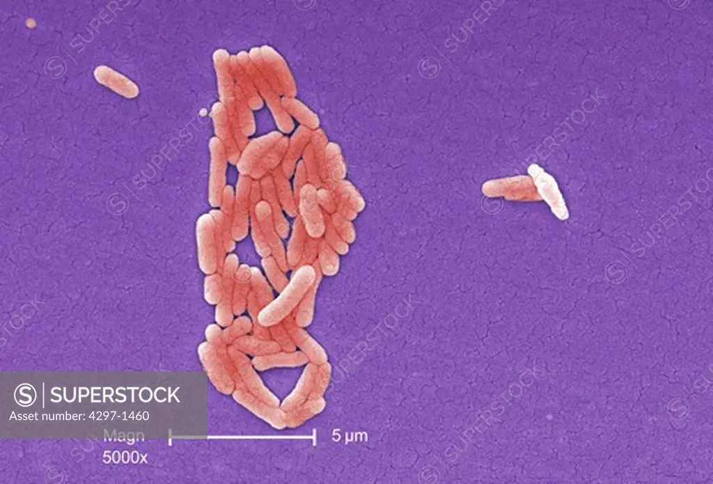 Under a magnification of 5000X, this colorized scanning photomicrograph shows numbers of clustered Gram-negative Salmonella typhimurium bacteria