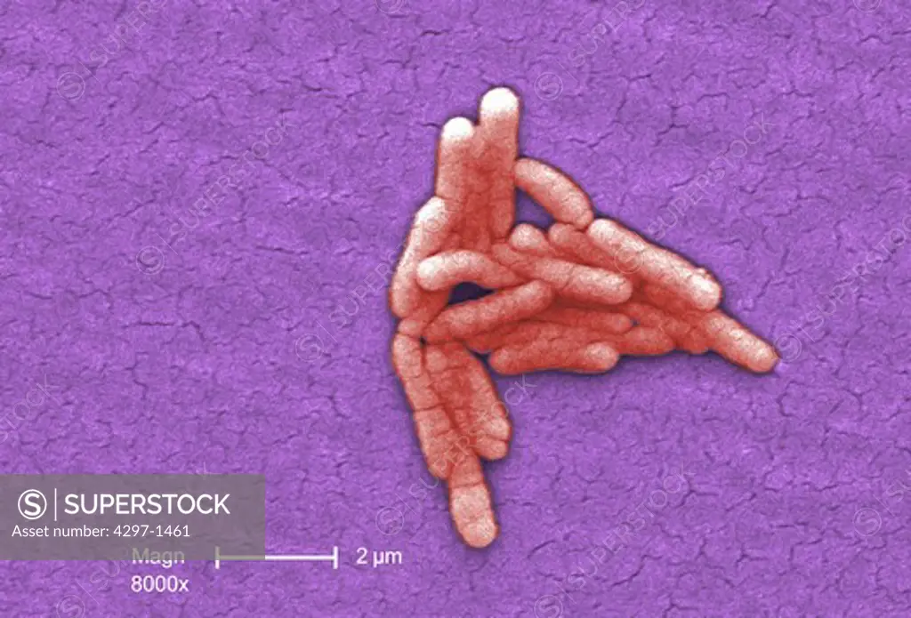 Colorized scanning photomicrograph shows numbers of clustered Gram-negative Salmonella typhimurium bacteria
