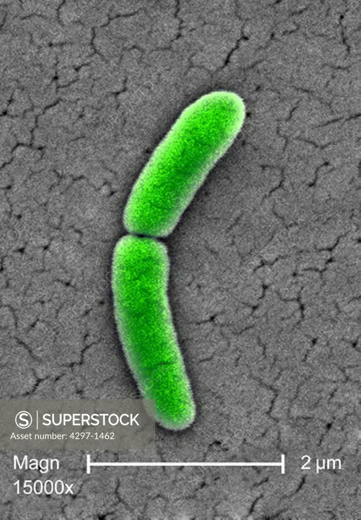 Under a very high magnification of 15000X, this scanning electron micrograph (SEM) revealed the presence of a single gram-negative Salmonella typhimurium bacterium, which was imaged right at the point where it was undergoing the process of cell division