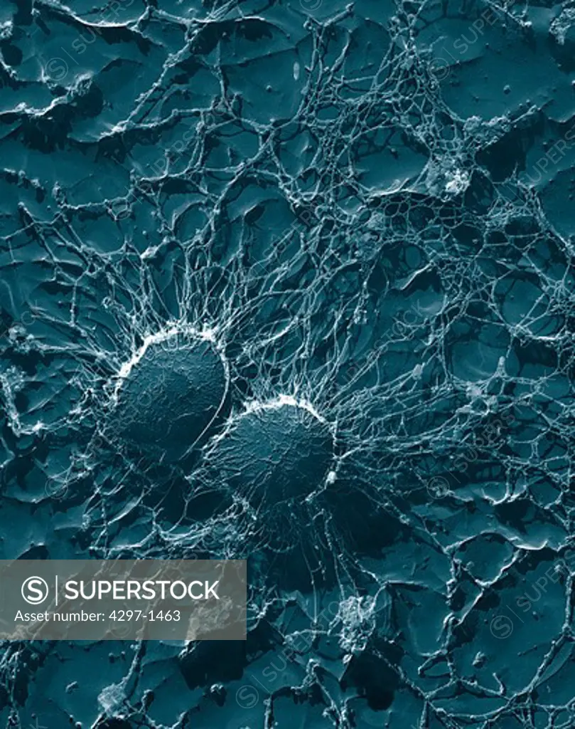 TEM of bacterial cells of Staphylococcus aureus, its large capsule protects the bacterium from attack by immunological defenses