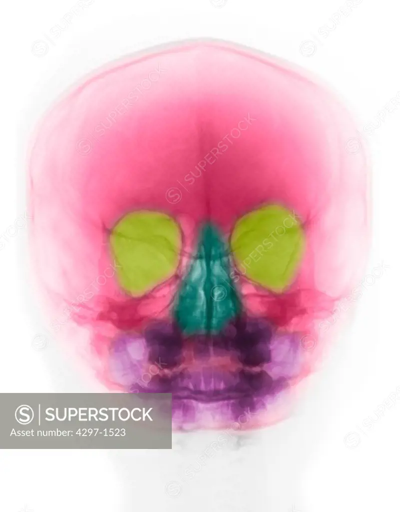 Colorized normal skull x-ray of a child