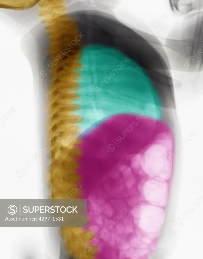 Colorized normal lateral abdomen x-ray of a 9 day old girl. The spine has been highlighted in yellow, the lungs in blue, and the abdominal cavity in pink