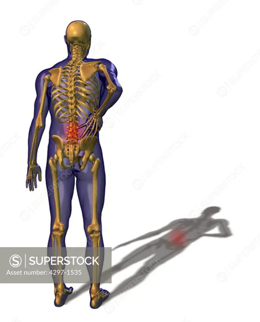 Illustration showing a person suffering from back pain