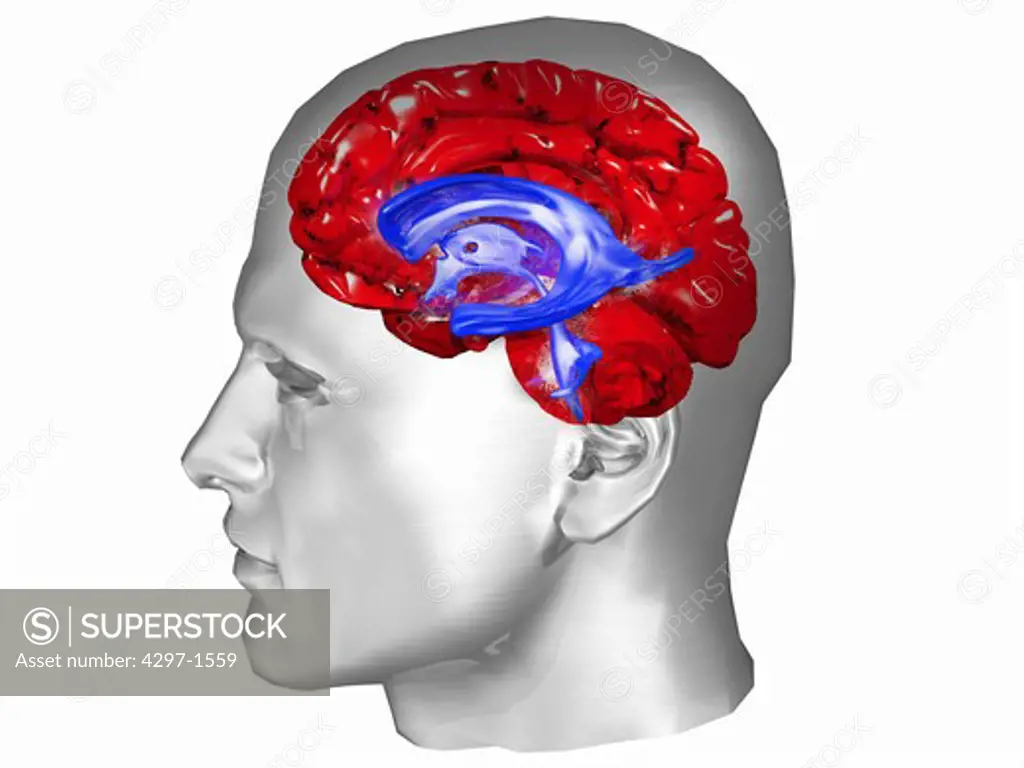 Illustration of the human brain showing the anatomical relationships between the ventricles and the surface of the brain. The ventricular system are the structures containing the cerebrospinal fluid