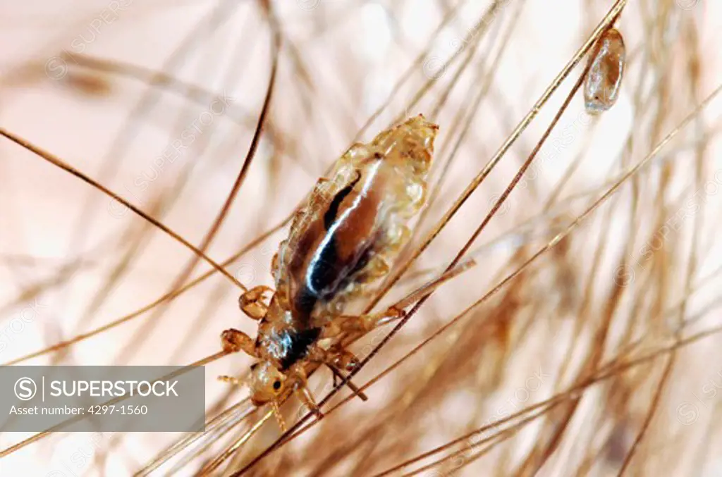 Human head louse clinging to the hair. An empty egg case (nit) is seen in the upper right attached to a hair