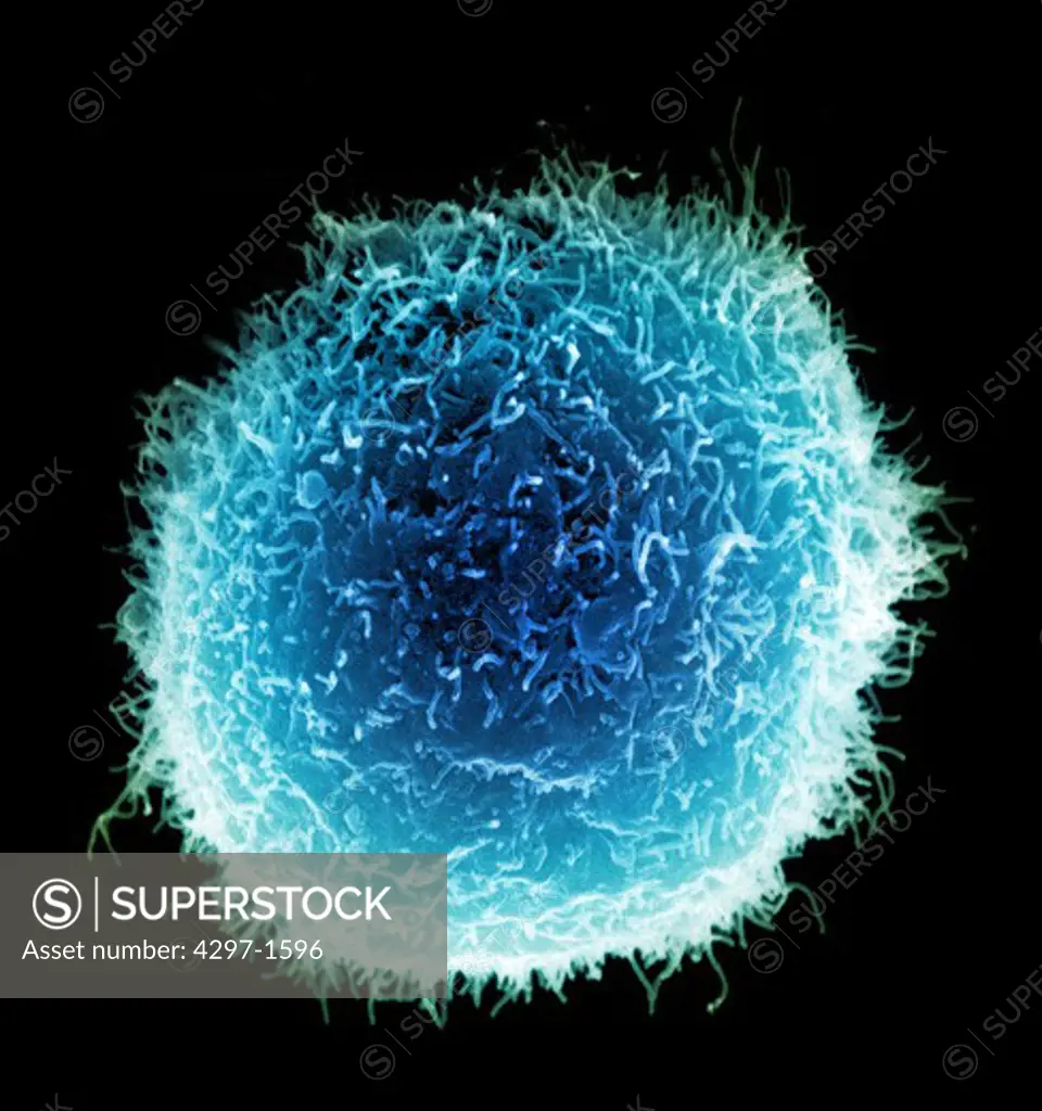 Scanning electron micrograph of a single macrophage with projectile-looking surface